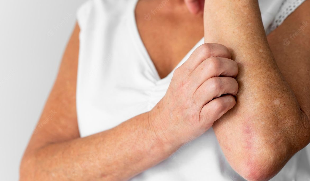 Apa Saja Tanda-Tanda Reaksi Alergi Terhadap Obat