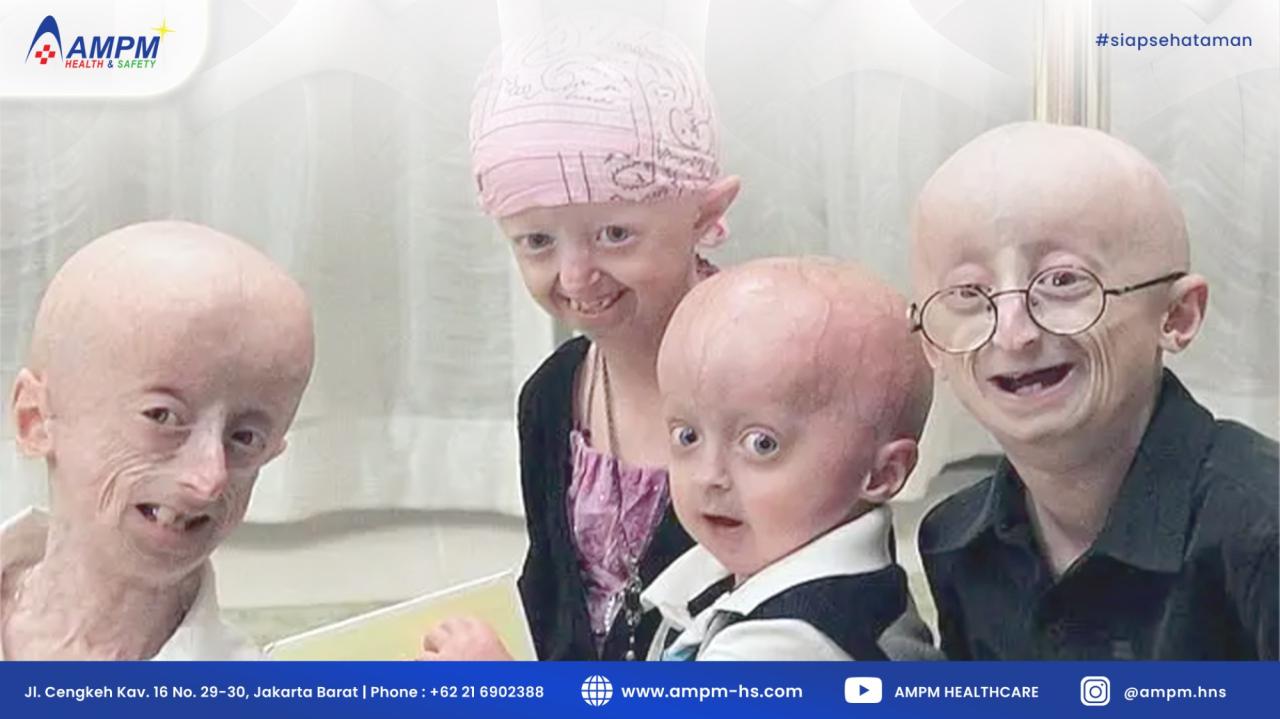 Penyakit Langka Yang Ada di Dunia